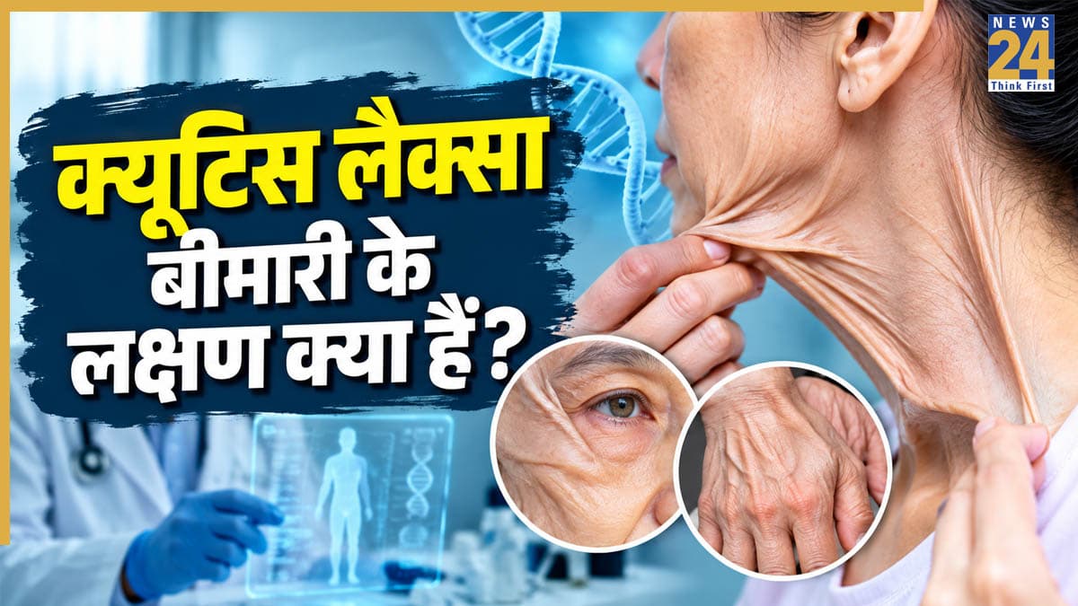 6 साल की उम्र में दिखने लगते हैं बुढ़ापे के लक्षण, जानिए किसे कहते हैं क्यूटिस लैक्सा?