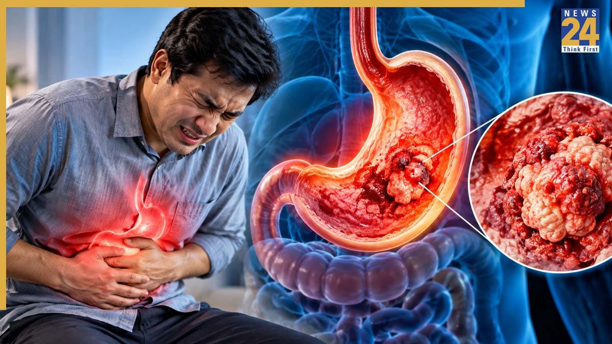 पेट में हर समय जलन महसूस होना कैंसर का लक्षण तो नहीं? यहां जानिए Stomach Cancer के क्या हैं संकेत