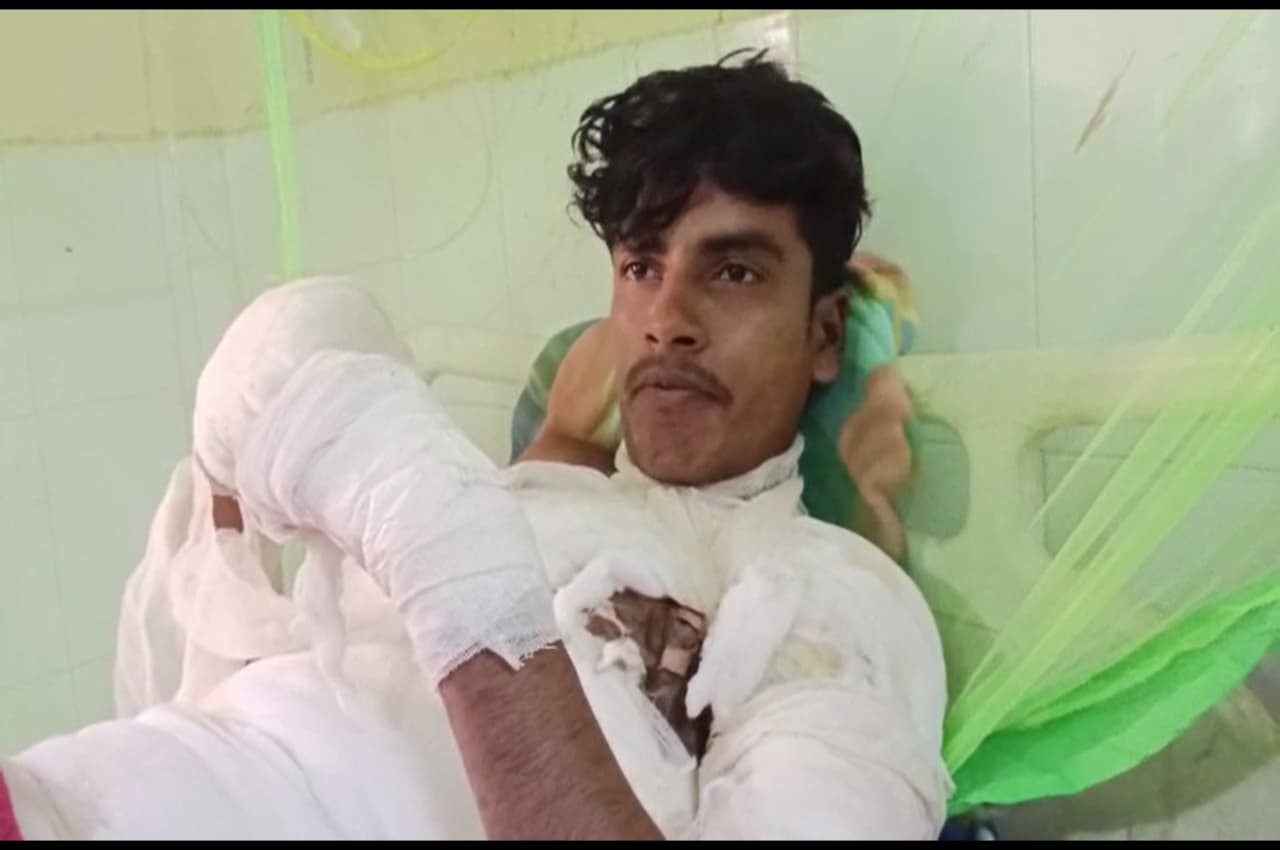 हवालात में बंद युवक ने खुद को लगाई आग, SP जीआरपी ने थानेदार के खिलाफ लिया बड़ा एक्शन