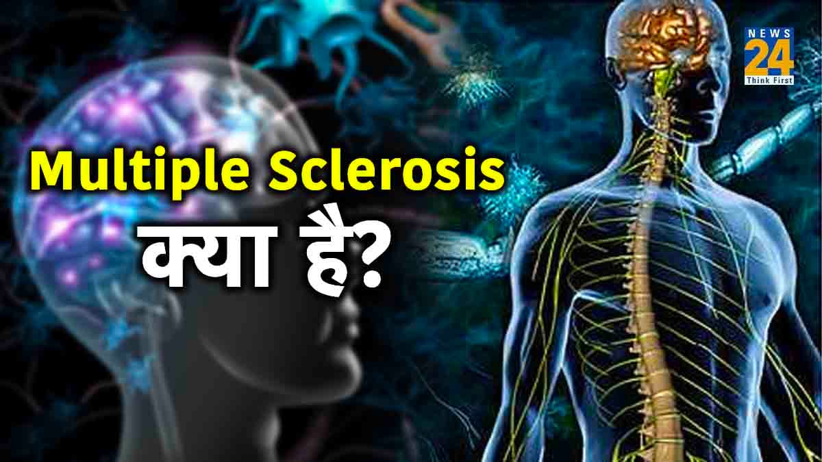 Multiple sclerosis multiple sclerosis,multiple sclerosis cause,multiple sclerosis diagnosis,multiple sclerosis life expectancy,what causes multiple sclerosis in females,multiple sclerosis symptoms in females,multiple sclerosis pathophysiology,multiple sclerosis medication,multiple sclerosis symptoms in females,multiple sclerosis diagnosis,multiple sclerosis life expectancy