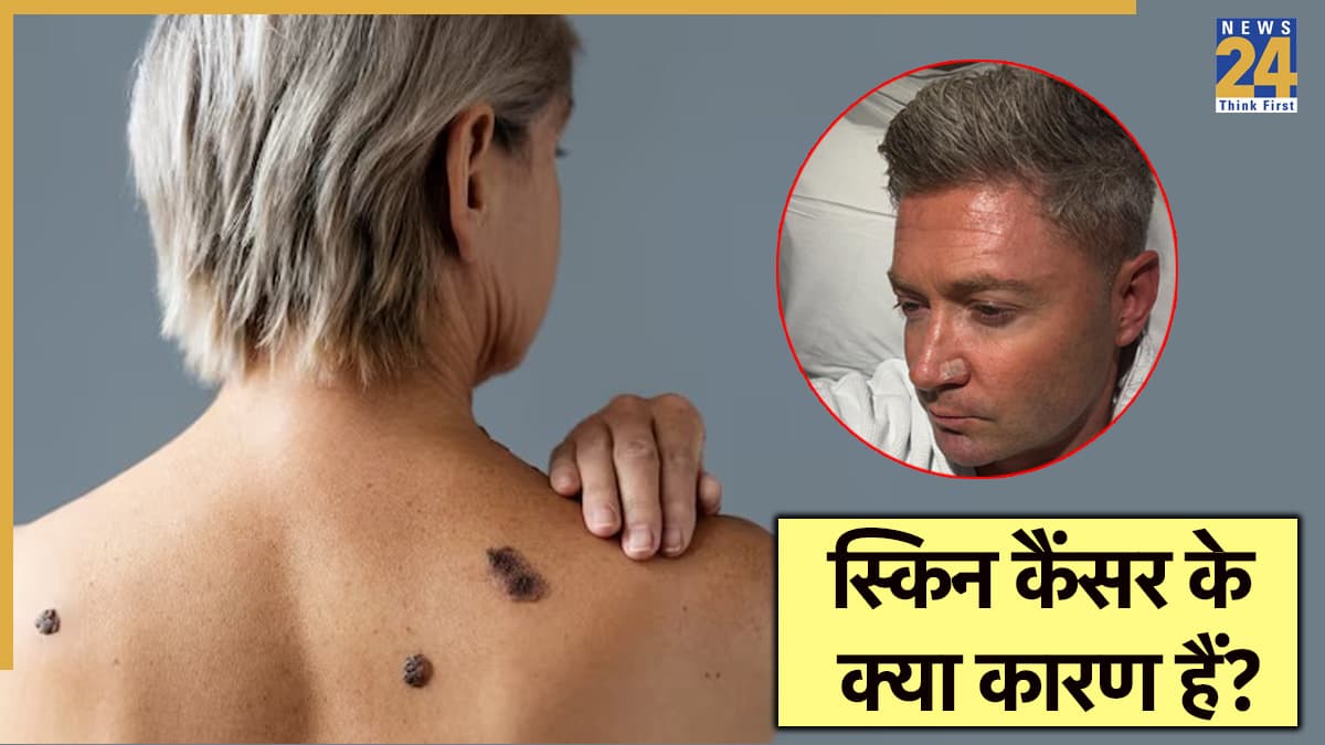 स्किन कैंसर क्या? जिसका शिकार हुए दिग्गज क्रिकेटर माइकल क्लार्क, डॉक्टर से जानें संकेत और उपाय