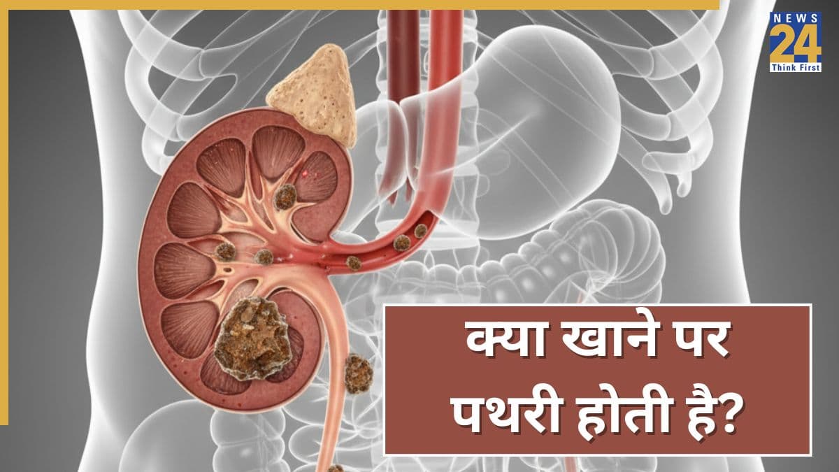 पथरी क्या चीज खाने से बनती है? डॉक्टर ने कहा बार-बार होते हैं Kidney Stones तो थाली से निकाल दें ये फूड्स