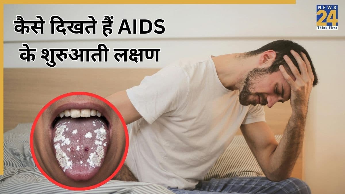AIDS Symptoms: एड्स के शुरुआती लक्षण क्या हैं? डॉक्टर ने बताया HIV होने पर जीभ पर दिखता है यह निशान