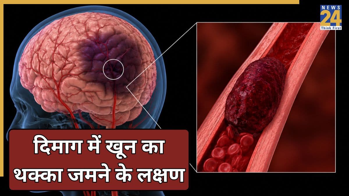 दिमाग में खून का थक्का जमने पर नजर आते हैं ये 6 लक्षण, स्ट्रोक आने से पहले शरीर देता है यह चेतावनी