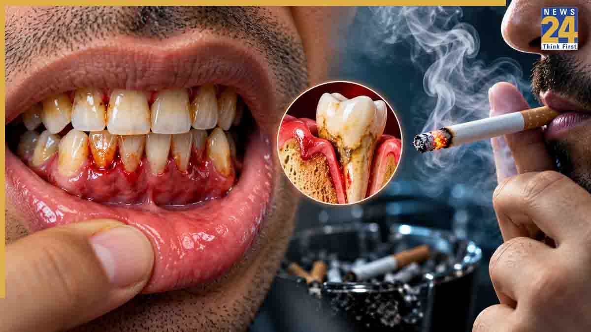 क्या स्मोक करने वालों के मसूड़े हो जाते हैं खराब? जानिए स्मोकिंग Gum Disease का कारण बनती है या नहीं
