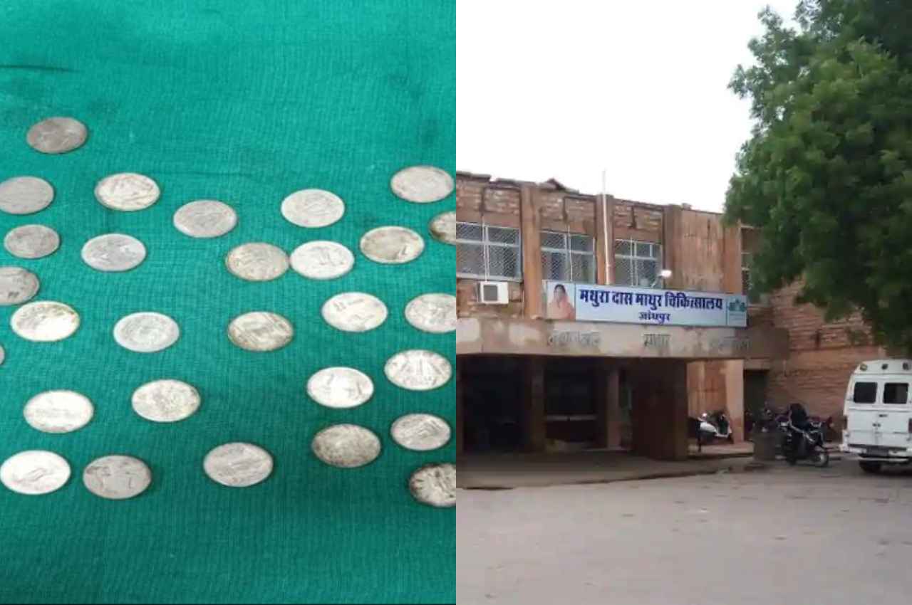 Rajasthan: युवक के पेट का एक्सरे देख डॉक्टर के उड़े होश, ऑपरेशन कर निकाले 63 सिक्के