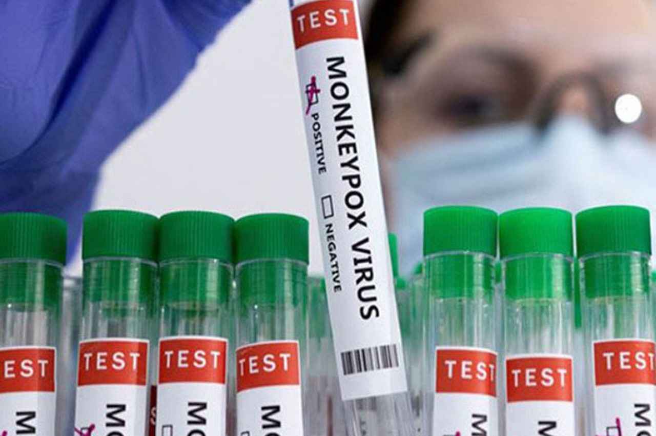 Monkeypox: मंकीपॉक्स से निपटने के लिए केंद्र सरकार तैयार, गाइडलाइन जारी