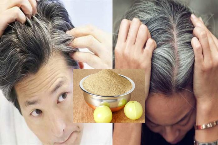 Amla removes many hair problems