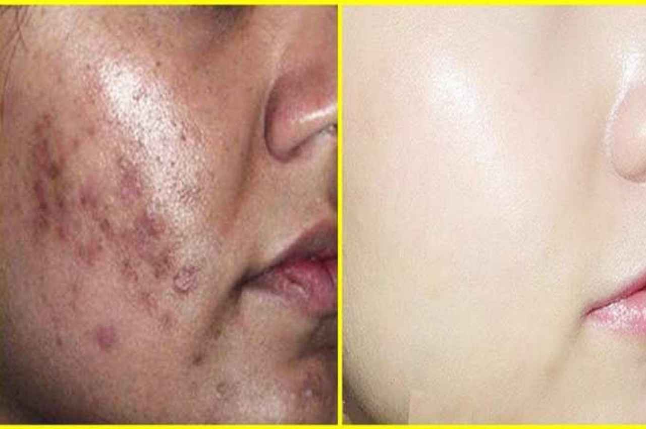 Morning Skin Care TIPS: मॉर्निंग में उठकर रोज करें बस ये 4 काम, स्किन पर हमेशा रहेगा ग्लो