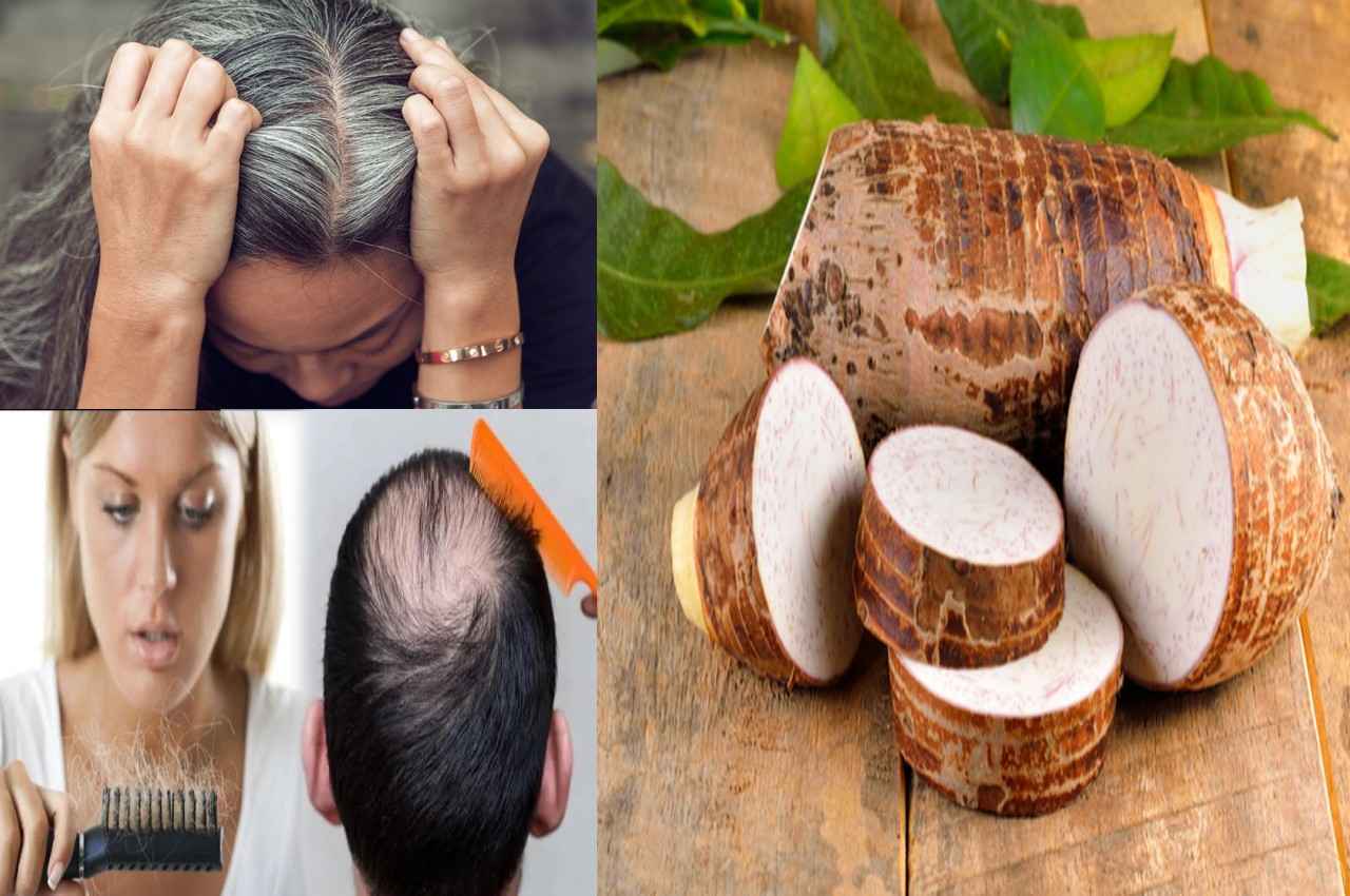 Hair Care Tips: हेयर में ऐसे लगाएं अरबी, सफेद बालों से मिलेगी निजात, ये 5 समस्याएं होंगी दूर