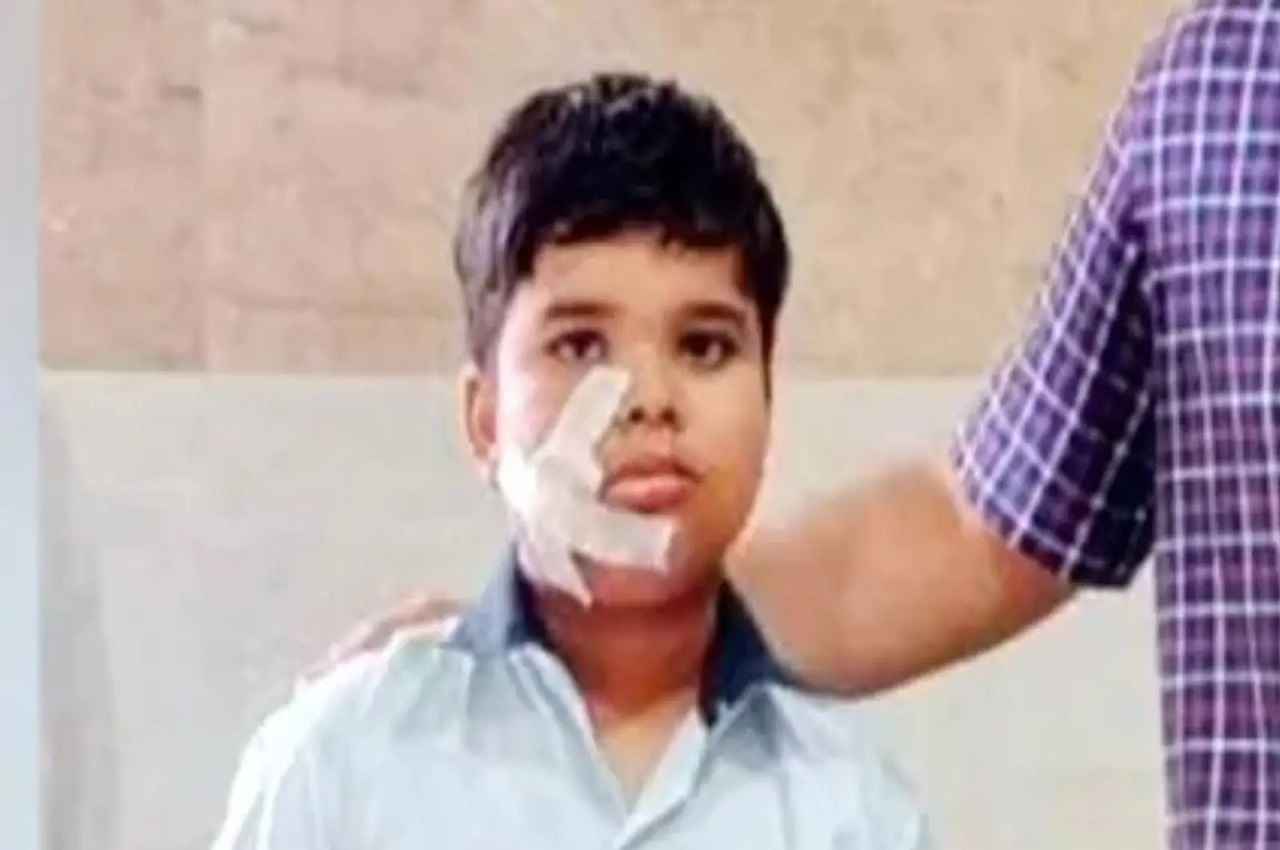 महाराष्ट्र: चार घंटे पहले जल चुकी स्पार्कल कैंडल फटी, जन्मदिन में गया बच्चा गंभीर रूप से हुआ घायल