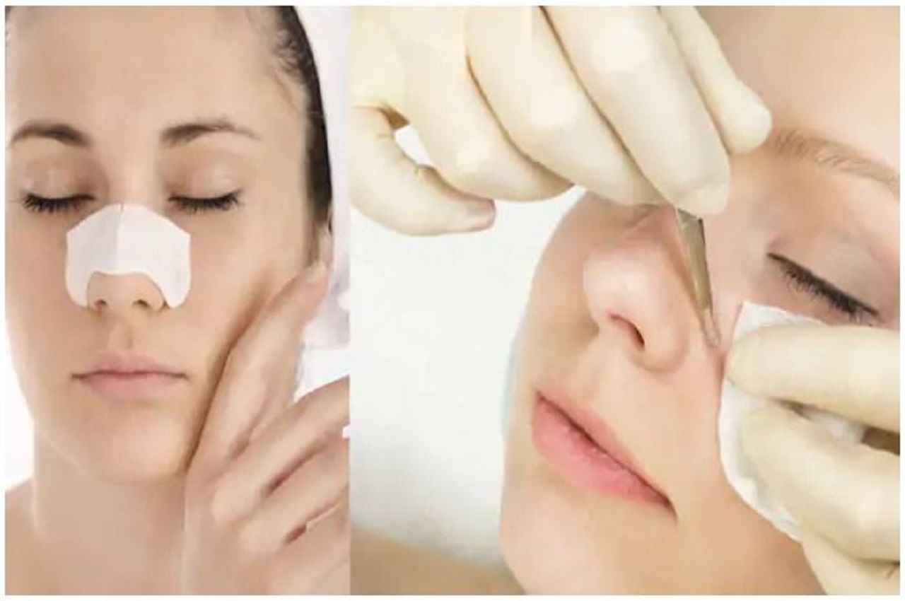 How To Get Rid Of Whiteheads: व्हाइटहेड्स को हटाने के लिए फेस पर ऐसे लगाएं बादाम, रंगत में भी होगा सुधार, जानें विधि