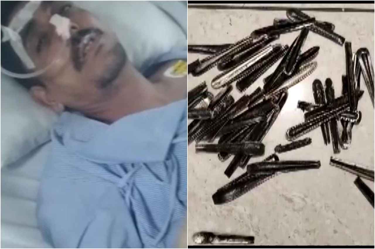 अजब-गजबः युवक के पेट से निकलीं ये खतरनाक चीजें, परिवार ने नशामुक्ति केंद्र पर लगाए गंभीर आरोप