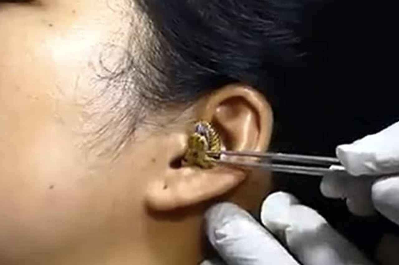 Viral Video: महिला के कान में घुसकर बैठ गया सांप, वीडियो देखकर सिहर जाएंगे आप