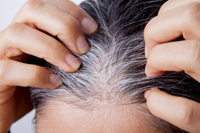 Hair Care home remedy for white hair problem