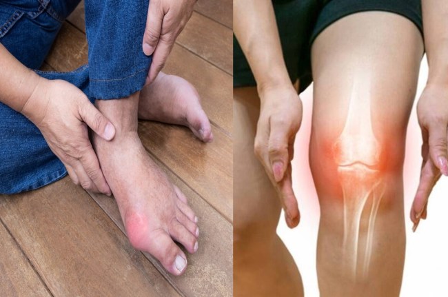 Uric Acid Control Foods