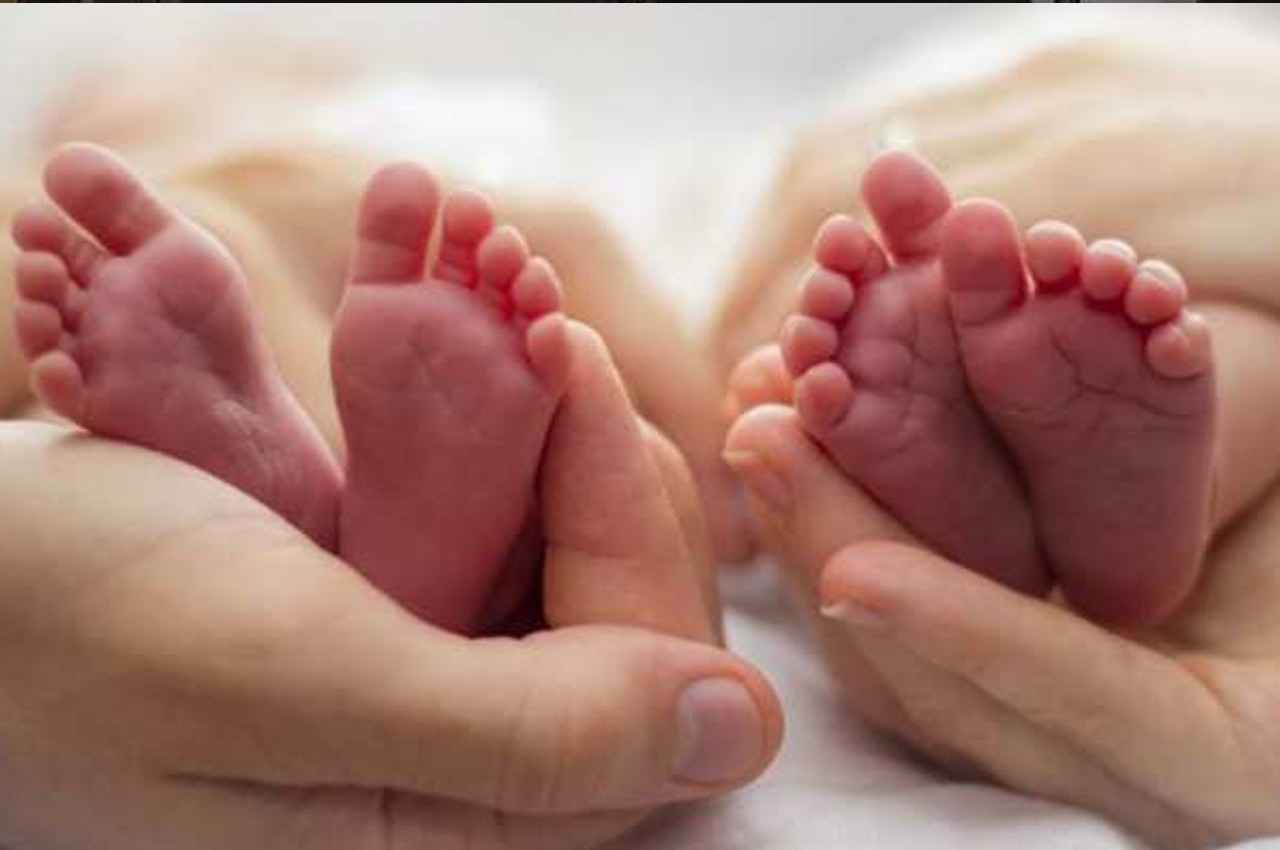rare twin birth