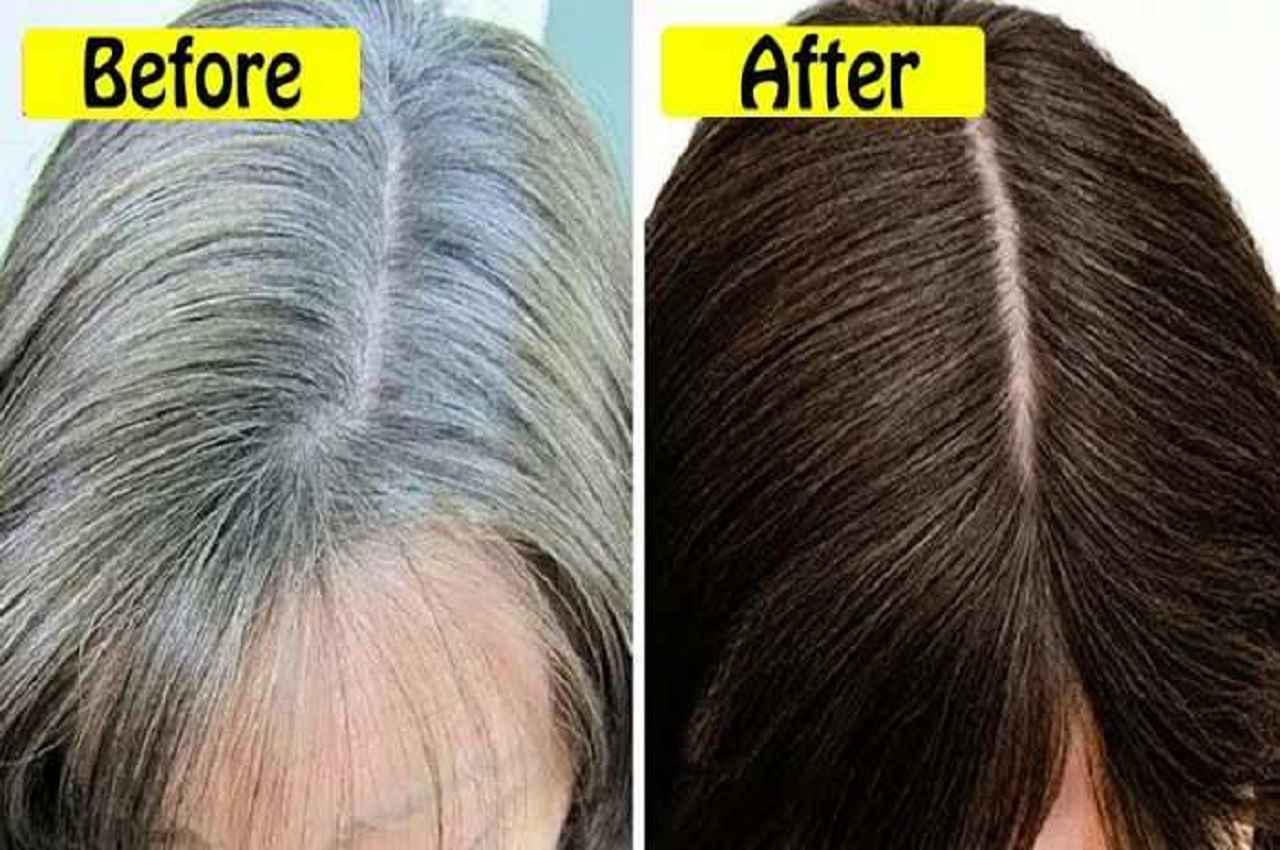 Remedy For White Hair: सफेद बालों को जड़ से काला कर देती है ये एक चीज, कुछ ही दिनों में दिखेगा असर