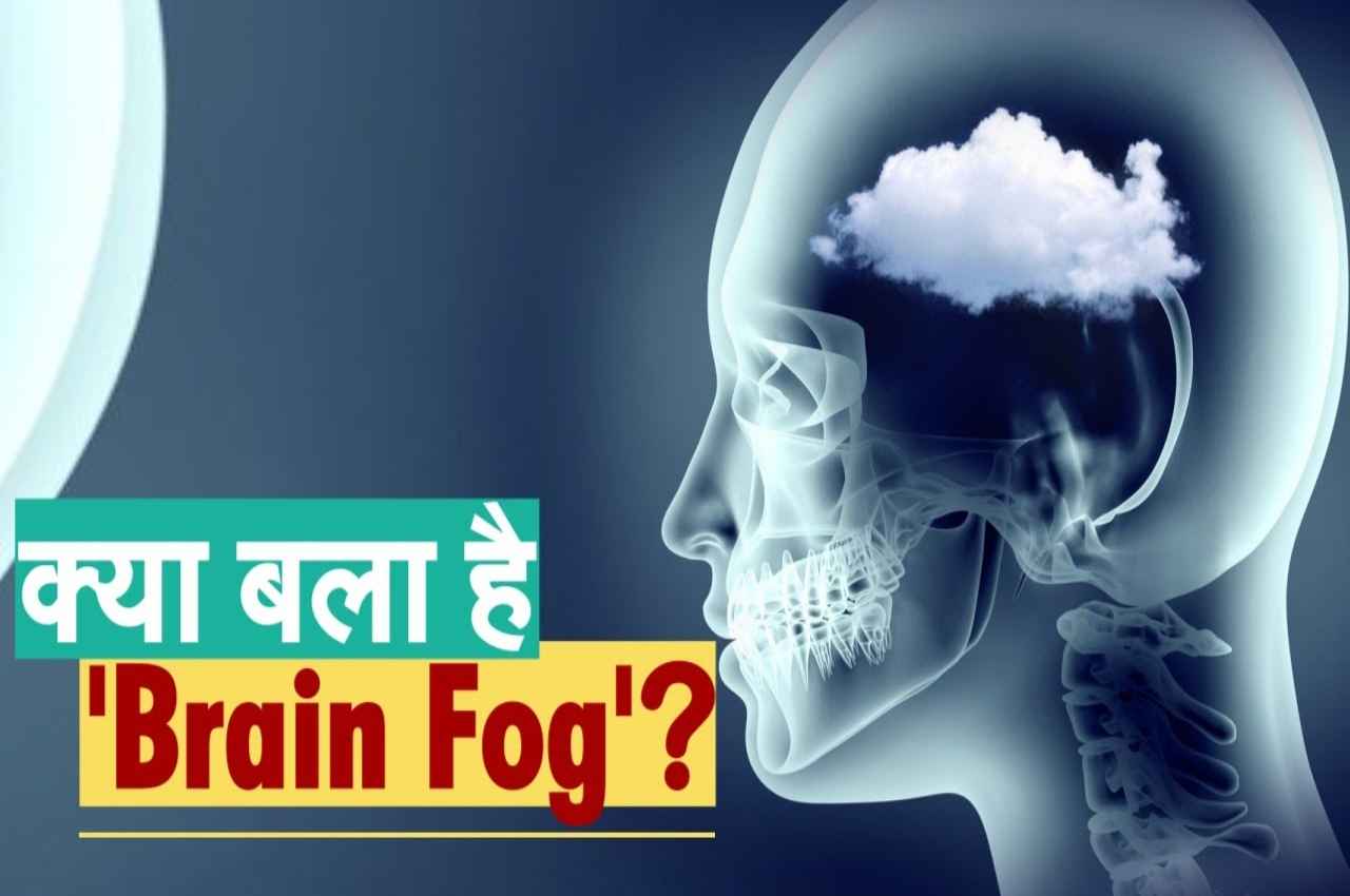 Brain Fog Brain Fog