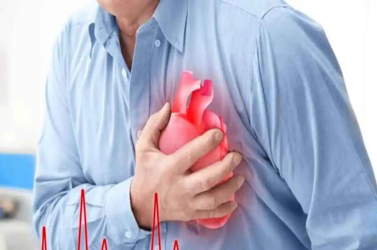 Heart attack Heart attack