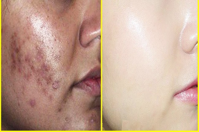 Oil Benefits soybean oil for Glowing skin