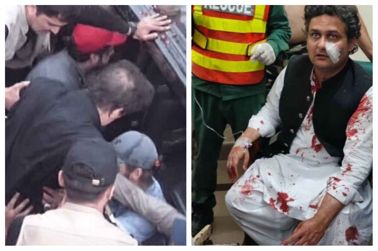 Imran Khan Attack: कंटेनर मार्च के दौरान पाकिस्तान के पूर्व प्रधानमंत्री इमरान खान को गोली मारी