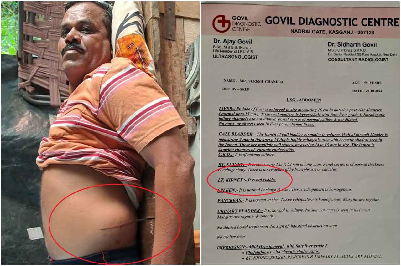 डॉक्टर के पास गया था शख्स स्टोन निकलवाने, लेकिन जो हुआ उसे जानकर पैरों तले जमीन खिसक गई