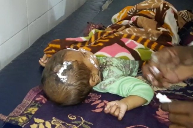 Mother saved her 6 month old innocent in Kota