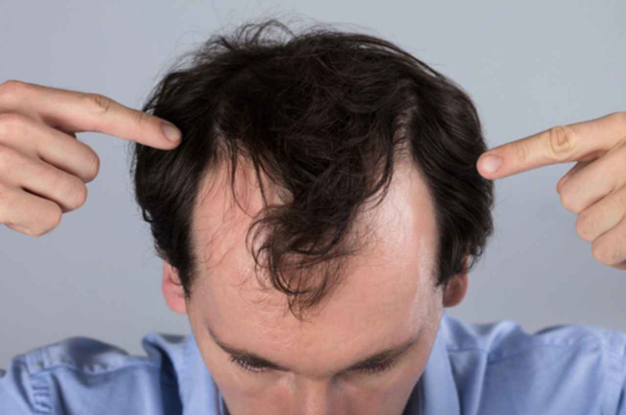 Hair Fall Stop: टूटते बालों को जड़ से मजबूत बनाए देंगी ये चीजें, सफेद होने की समस्या से भी मिलेगा निजात