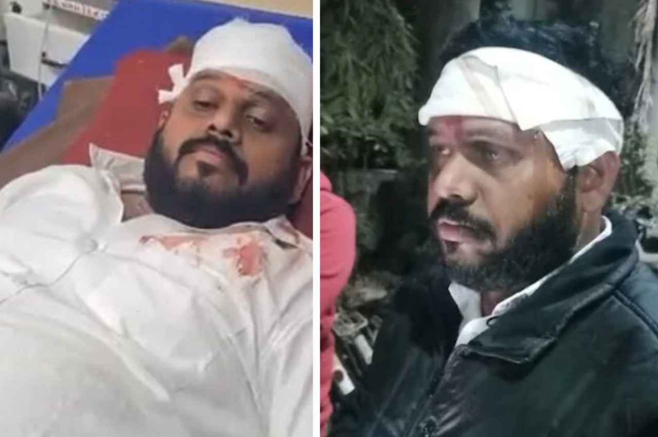 Gujarat Election 2022: वंसदा से बीजेपी प्रत्याशी के साथ मारपीट, कांग्रेस समर्थकों पर हमले का आरोप