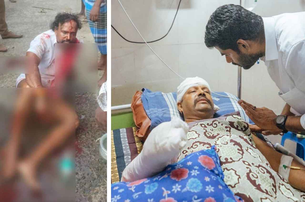 गांजे की बिक्री का खुलासा करने पर भाजपा नेता की बेरहमी से पिटाई, सड़क पर इस हाल में मिले