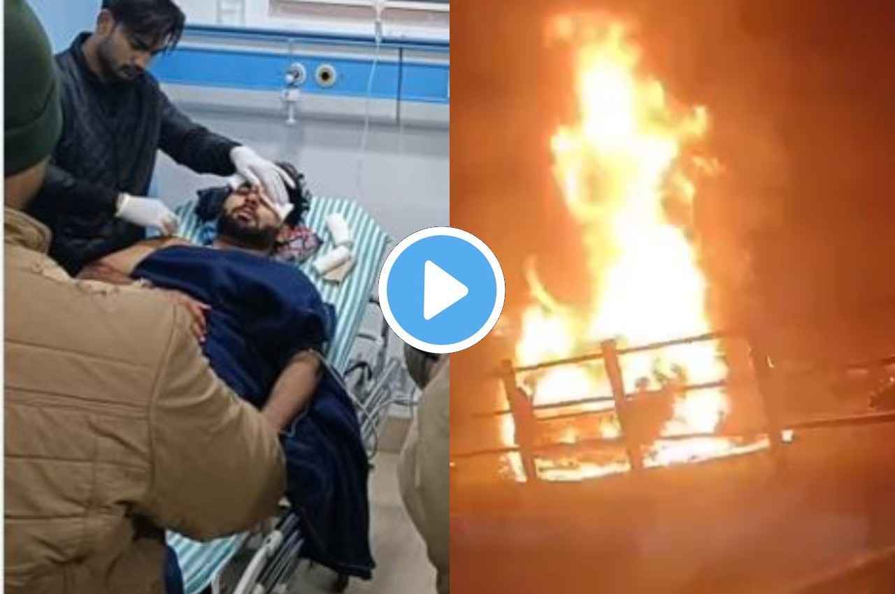 Rishabh Pant Accident health update Rishabh Pant Accident health update