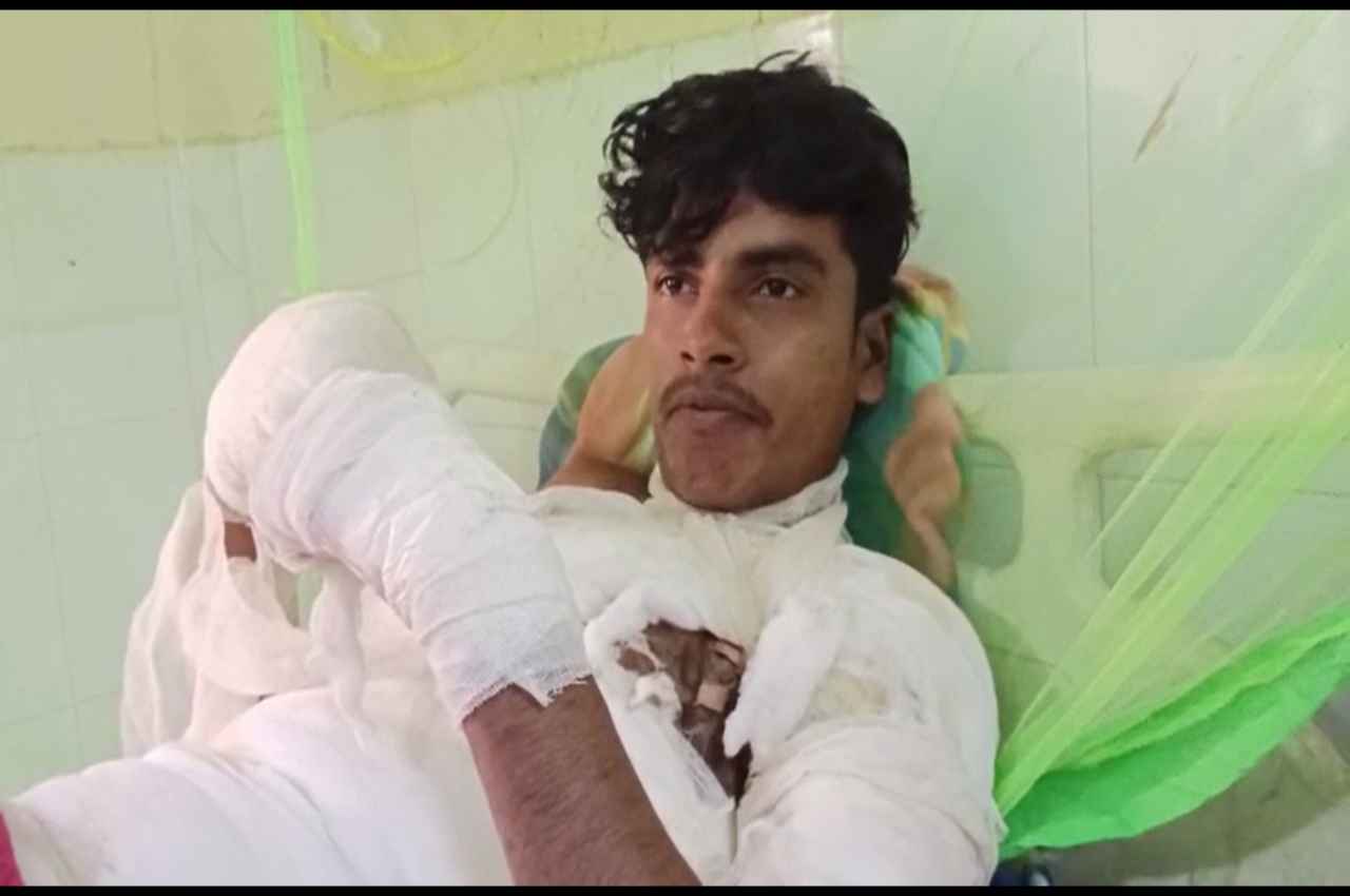 हवालात में बंद युवक ने खुद को लगाई आग, SP जीआरपी ने थानेदार के खिलाफ लिया बड़ा एक्शन