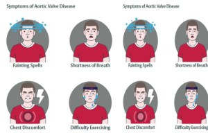 Health News Heart Valve Disease Symptoms