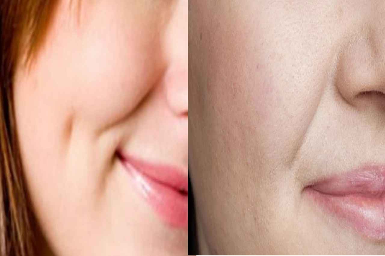 Skin Care: सर्दियों के मौसम में आजमाएं ये नुस्खे, स्किन की समस्याएं होंगी खत्म