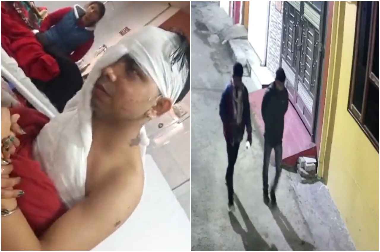Lucknow Acid Attack: घर में घुसकर मां और नाबालिग बेटे पर तेजाब से हमला, जल गया चेहरा-सीना, देखें Video