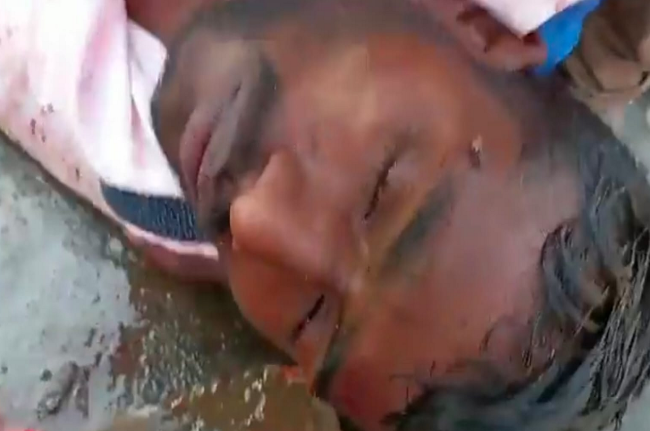 Man Ke Baat, TMC Goons Attack Bjp Worker