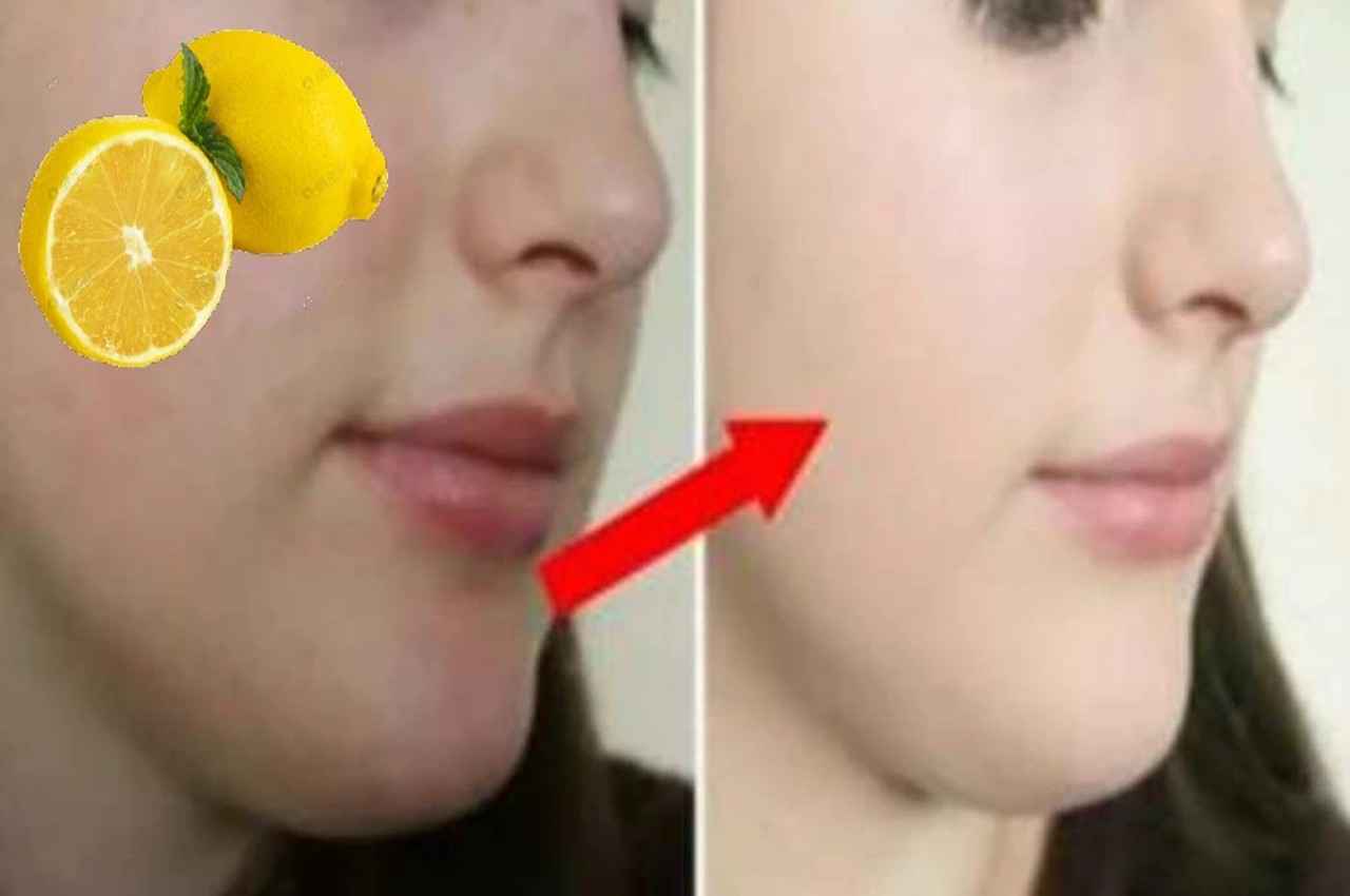 Skin Care TIPS: चेहरे के ब्लैकहेड्स और दाग-धब्बे हटा देगा नींबू, मिलेगा जबरदस्त निखार, ऐसे करें यूज