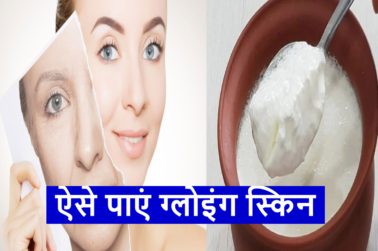 Skin Care TIPS Onion juice and curd beneficial for skin glowing skin
