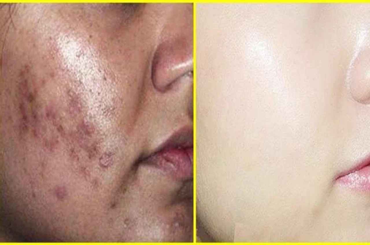 Skin care TIPS: दही में मिलाकर चेहरे पर लगाएं ये चीज, ऑयली स्किन-डेड सेल्स होगी गायब, मिल जाएगा मनचाहा निखार