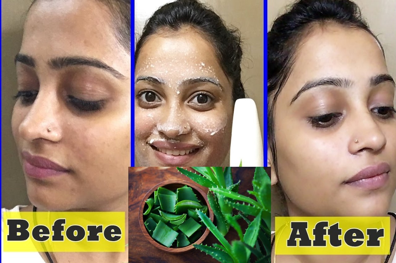 Skin Care TIPS Benefits of Aloe vera lemon face pack