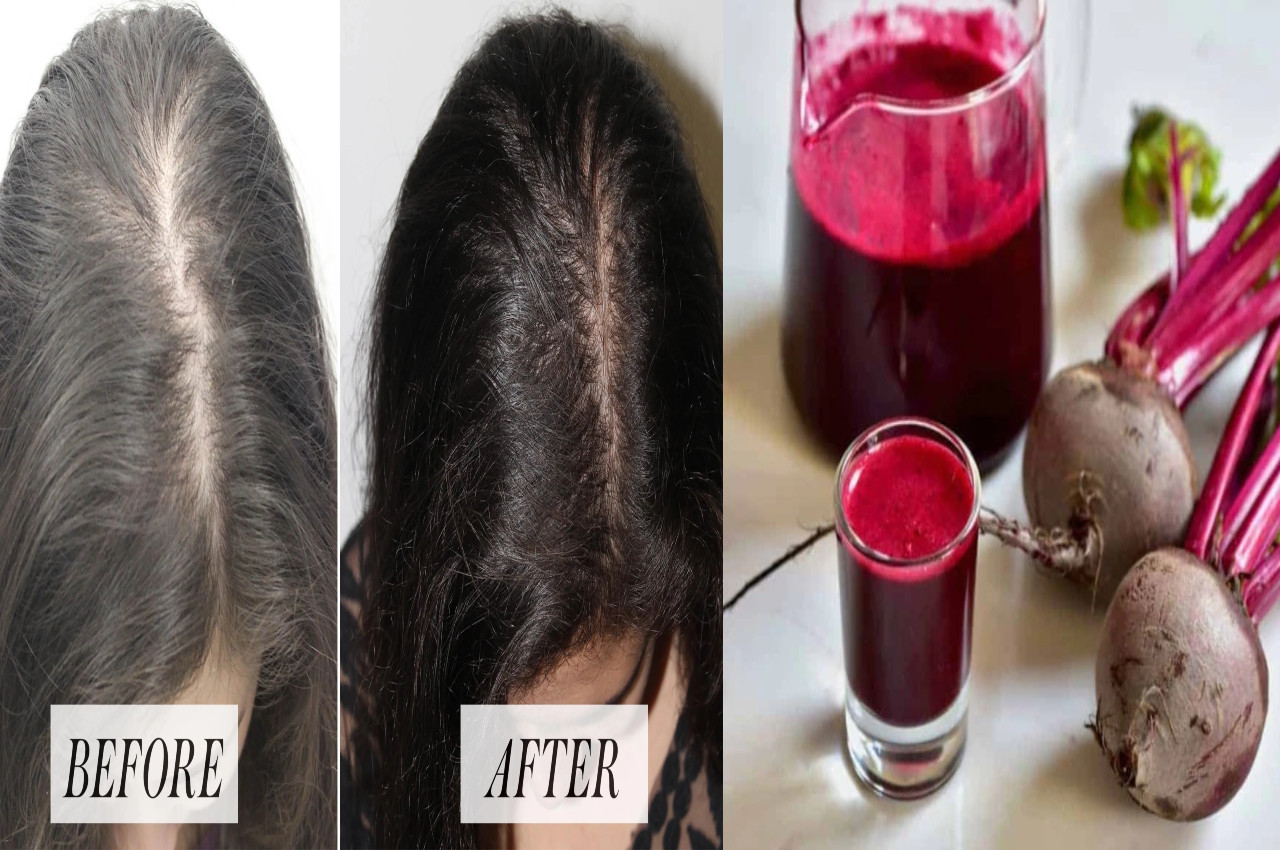 Hair Growth With Beetroot