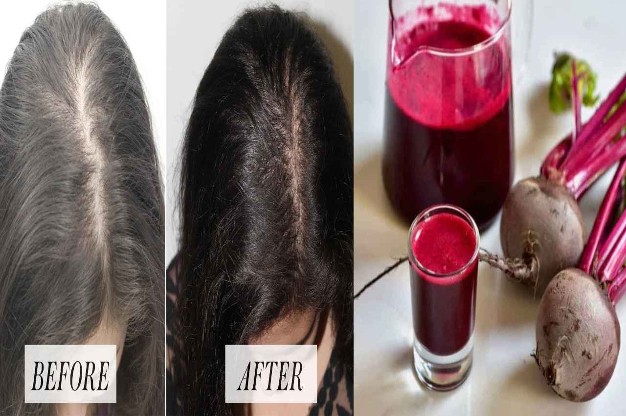 Hair Growth With Beetroot: तेजी से बालों की लंबाई बढ़ाएगा चुकंदर....बस ऐसे करें यूज, फिर देंखें कमाल