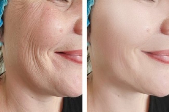 Wrinkles Treatment skin care routine