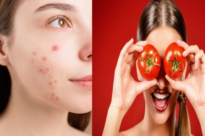 Skin Care TIPS Tomato is beneficial for glowing skin