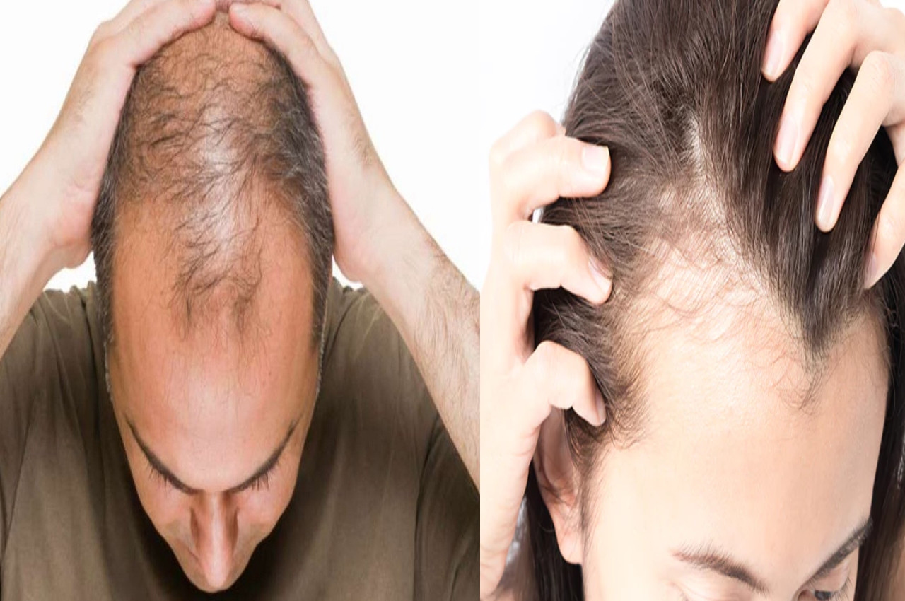 Hair Care TIPS Coconut oil will get rid of baldness