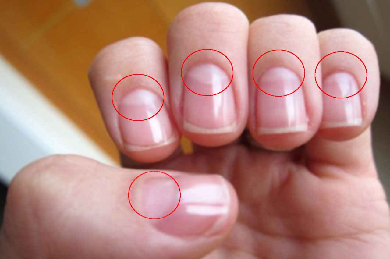 Palmistry Tips: अगर आपके हाथ के नाखूनों पर भी है सफेद अर्द्धचंद्र, तो जल्द मिलेगी यह खुशखबरी