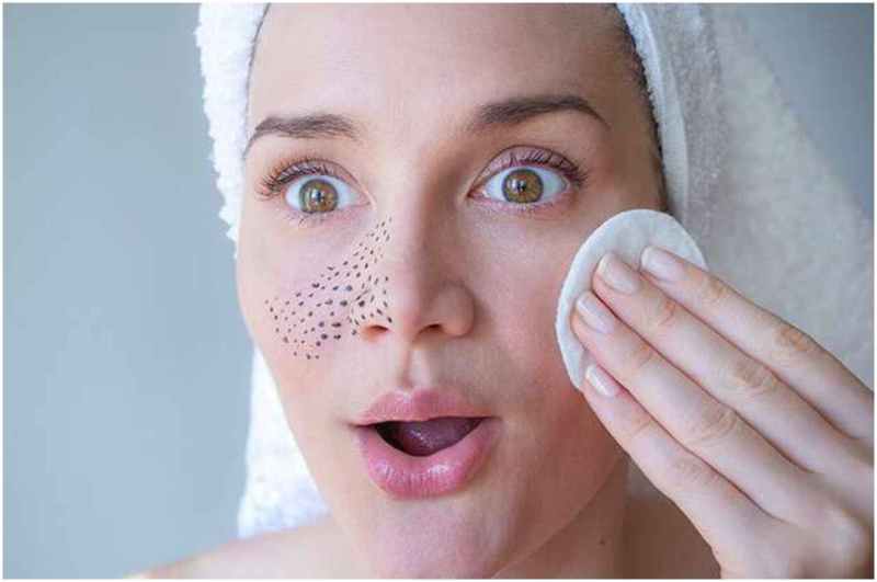 Blackheads Removing Tips