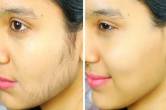 Face Hair Removal how to remove facial hair Chehre ke baal kaise hataye