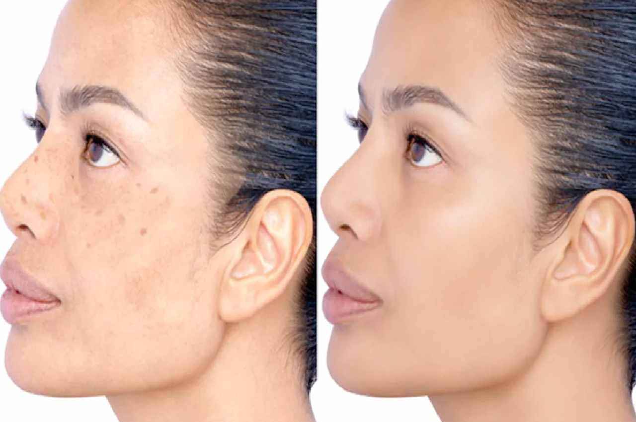 Glowing skin TIPS: ये 1 चीज बदल देगी चेहरे की रंगत....झुर्रियां-दाग होंगे गायब, मिलेगा खूबसूरत निखार